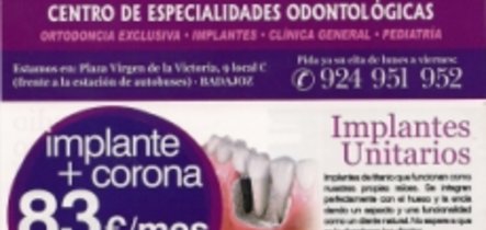 Qu es un implante dental