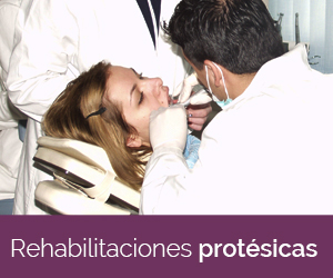 Rehabilitaciones protésicas