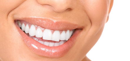Preguntas ms frecuentes sobre blanqueamiento dental